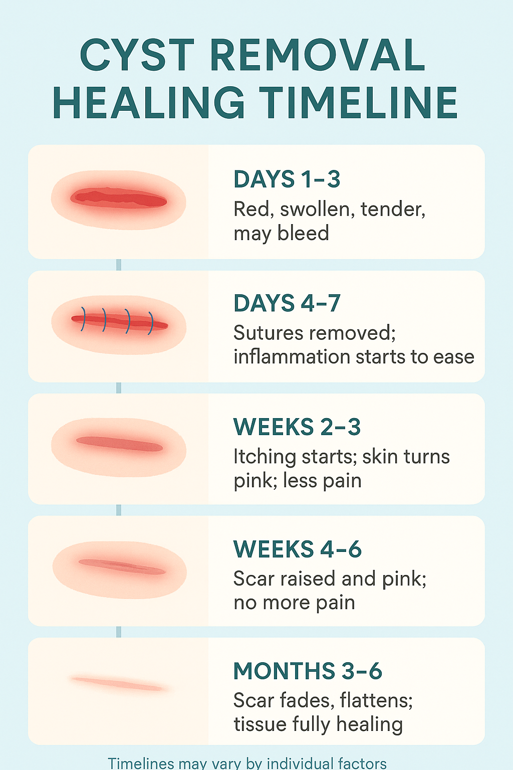 Cyst removal healing timeline