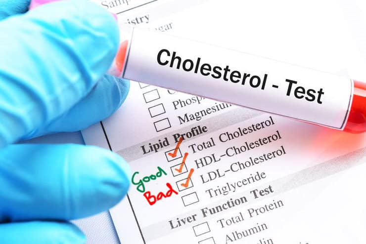 good vs bad cholesterol; HDL vs LDL