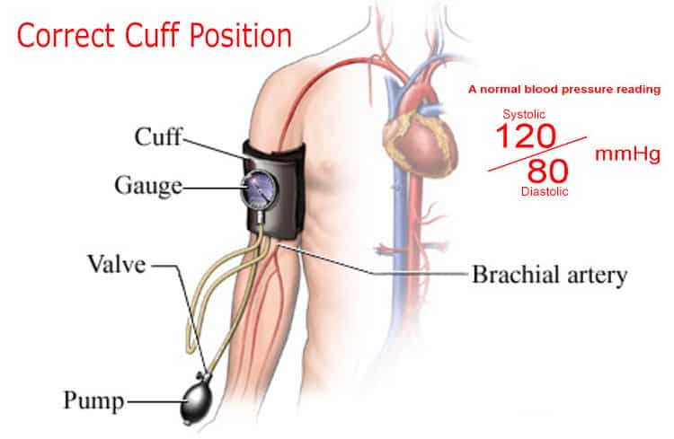 correct-cuff-position-in-bp-test