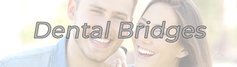 General Dentistry NYC Dental Bridges NYC p01 v01 Dental Bridges FAQ
