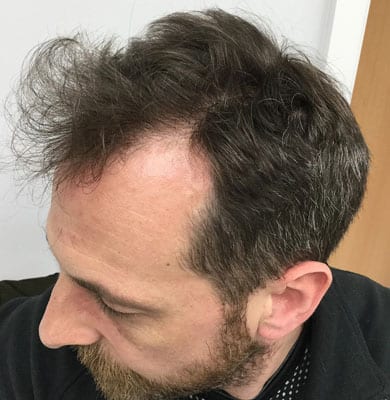 hair-transform