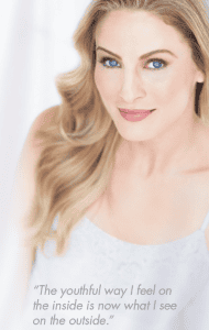 Voluma Juvederm