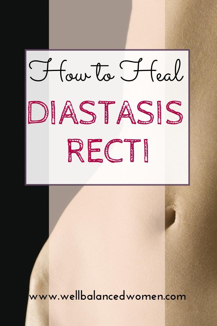 healing diastasis recti