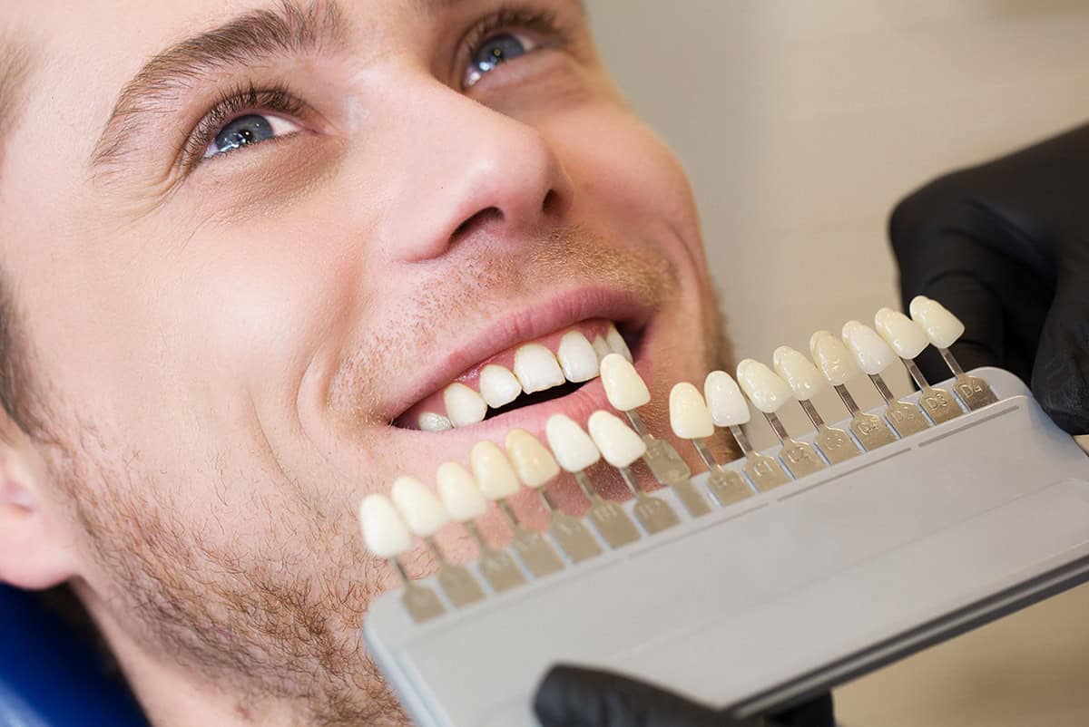 Tooth Bonding and Contouring Keynsham Dental Care