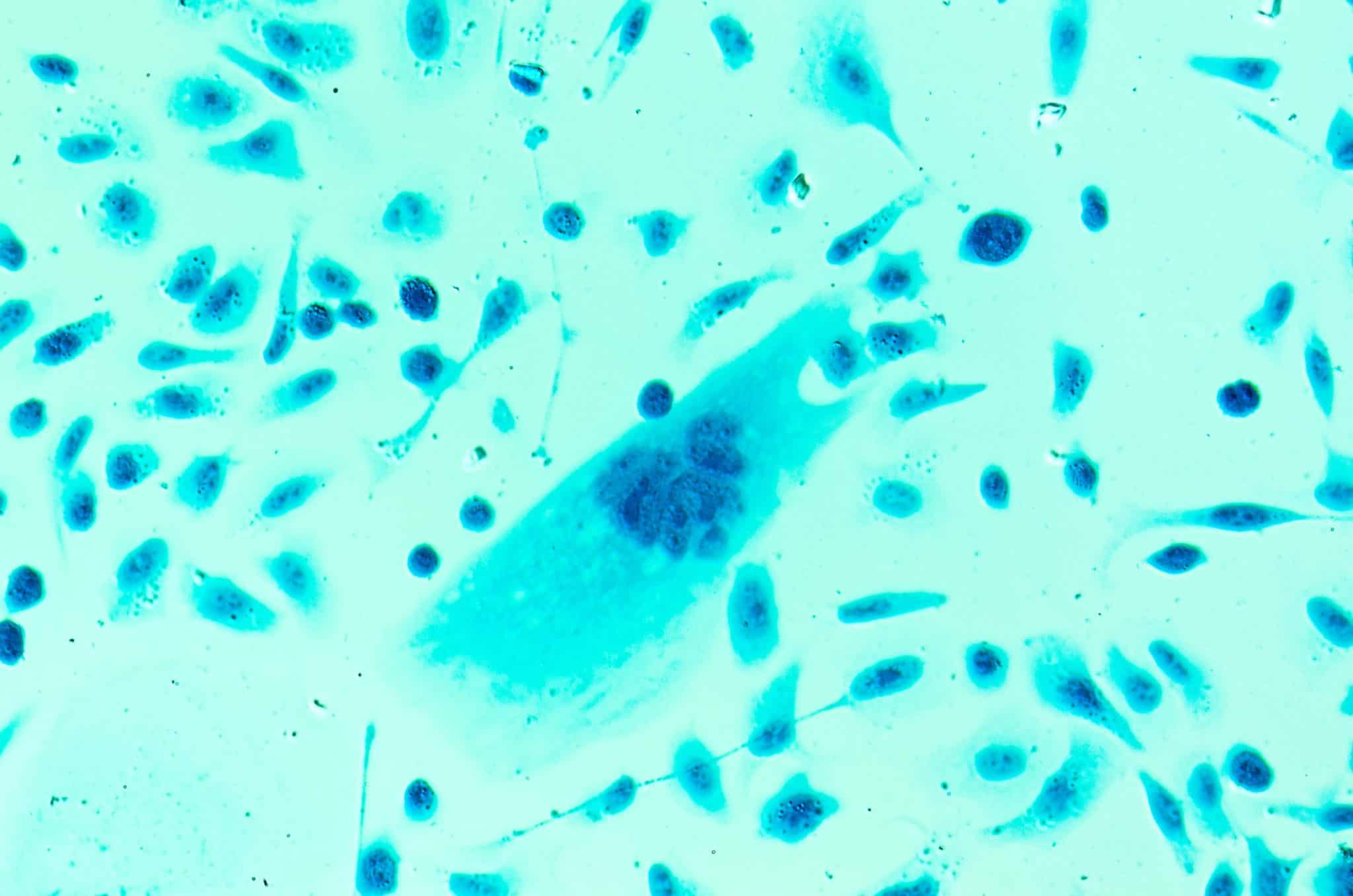 A new drug is producing “