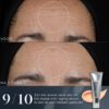 Crystal Retinal 10