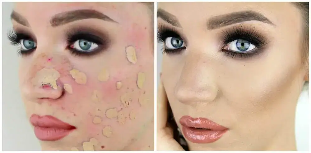 dermatologists