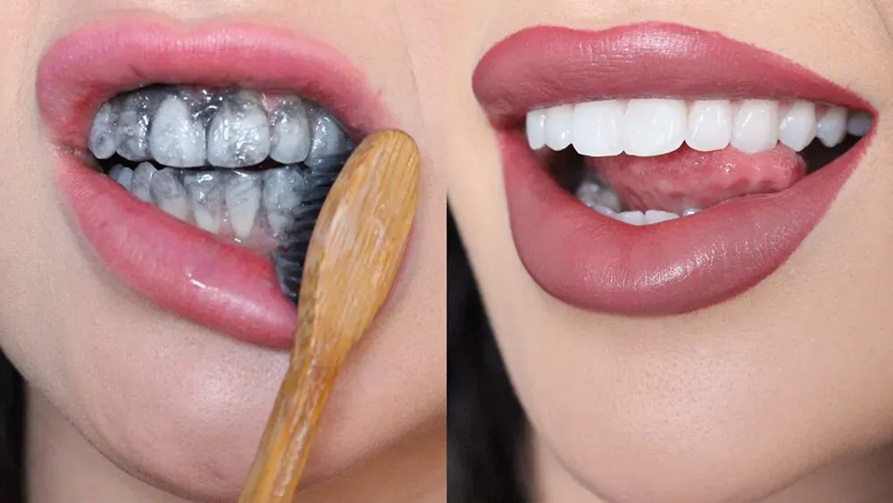 activated charcoal