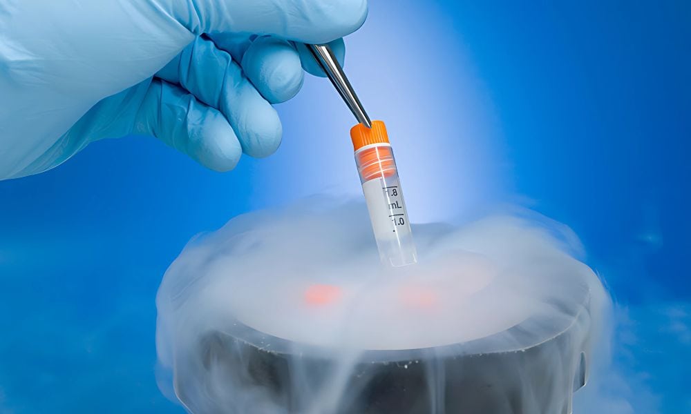 Fertility cryopreservation in Delhi