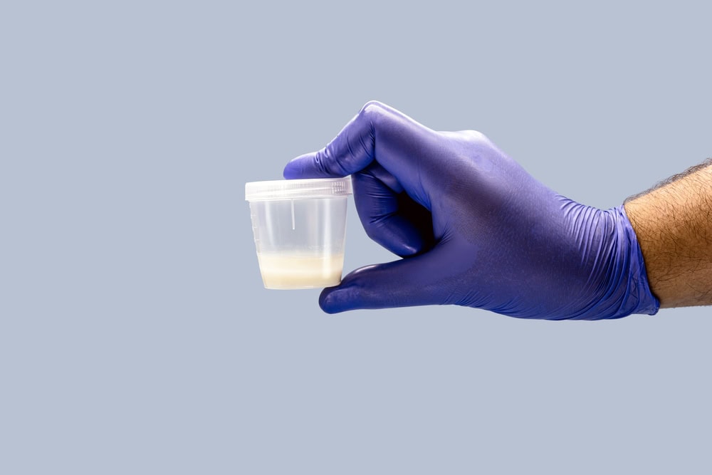 ONDE FAZER ESPERMOGRAMA: UM GUIA COMPLETO PARA DESVENDAR OS MISTÉRIOS DA FERTILIDADE MASCULINA