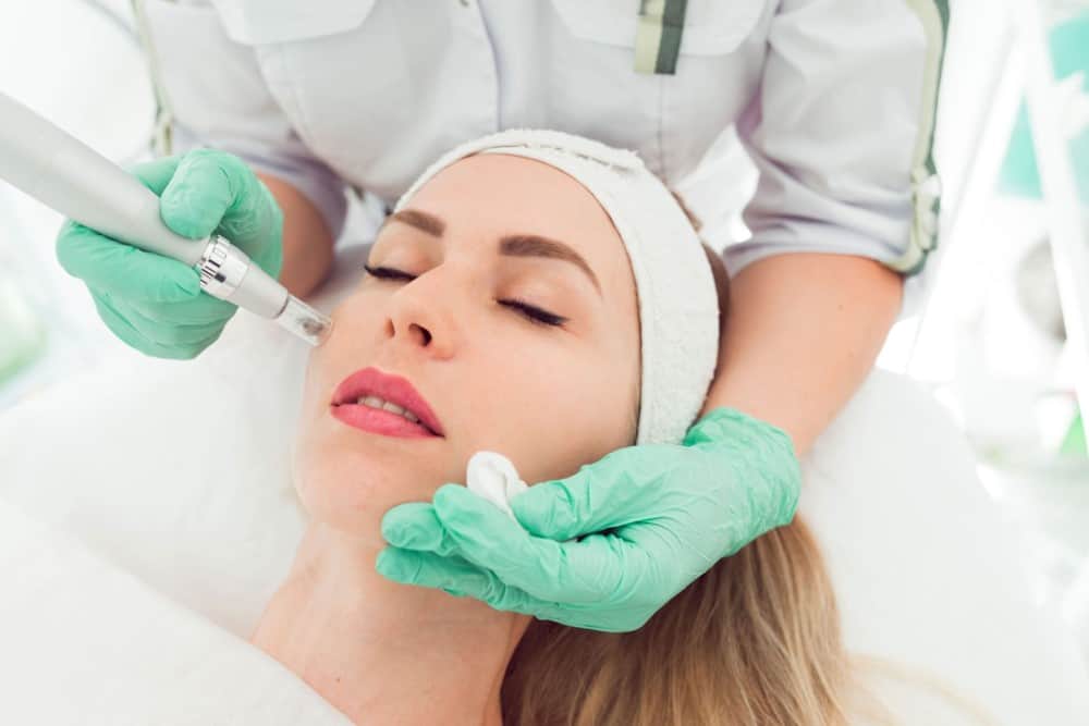 microneedling-malaga-vitali-beauty