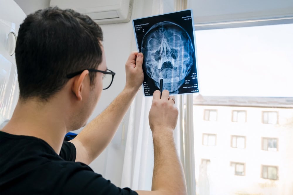 sinus-tooth-pain-dental-problem