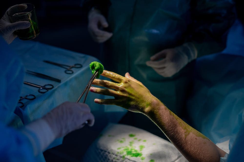 7 Common Hand Surgery Recovery Mistakes to Avoid