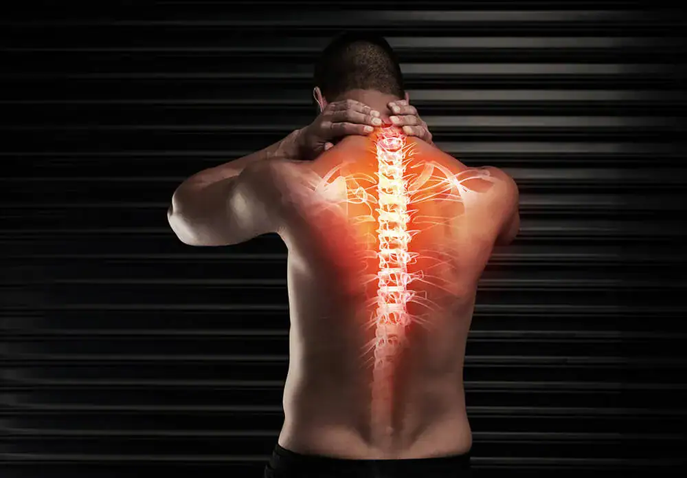xray image of a mans back