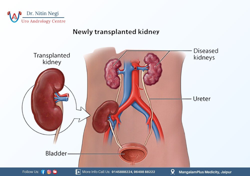 Best urologist in Jaipur