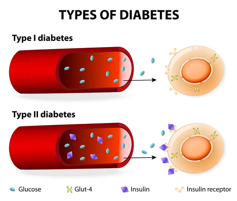 diabetes