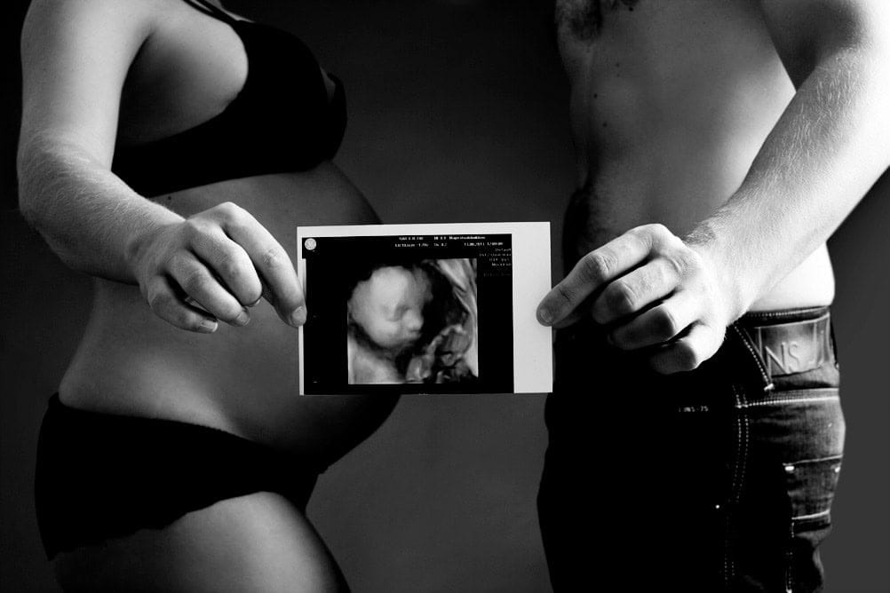 Unge gravid par holder ultralydbilde av fosteret mot magen, symbol på graviditet ogventyr. Mørk bakgrunn, svart-hvitt, fokus på trøstende øyeblikk og følelser i gravidfotografering.