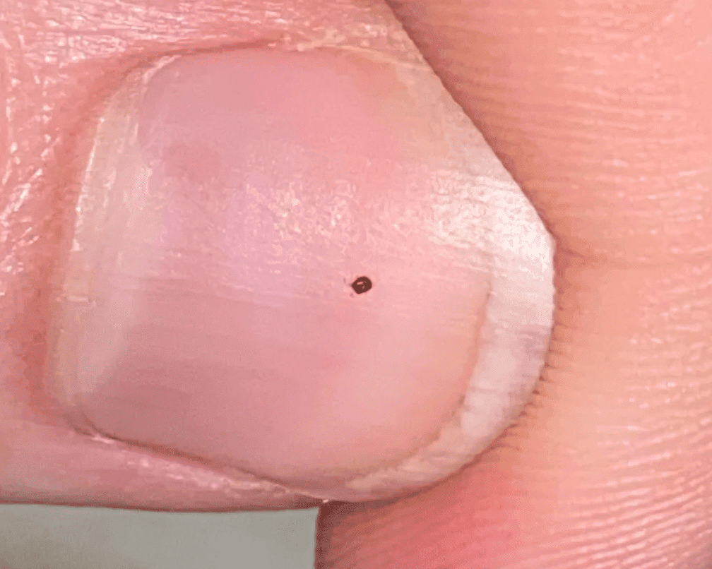How Long Do Bird Mites Live