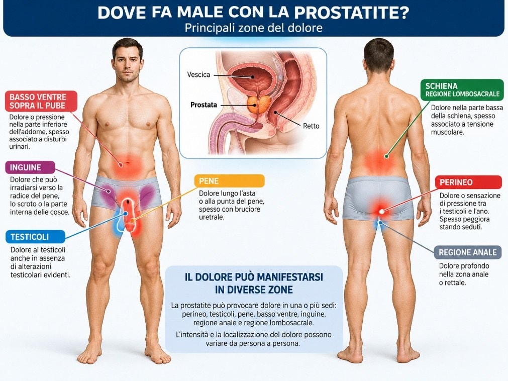 Zone del dolore nella prostatite: perineo, testicoli, pene, addome e schiena