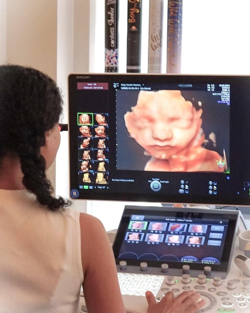 Geslachtsbepaling en 2D, 3D en 4D echo