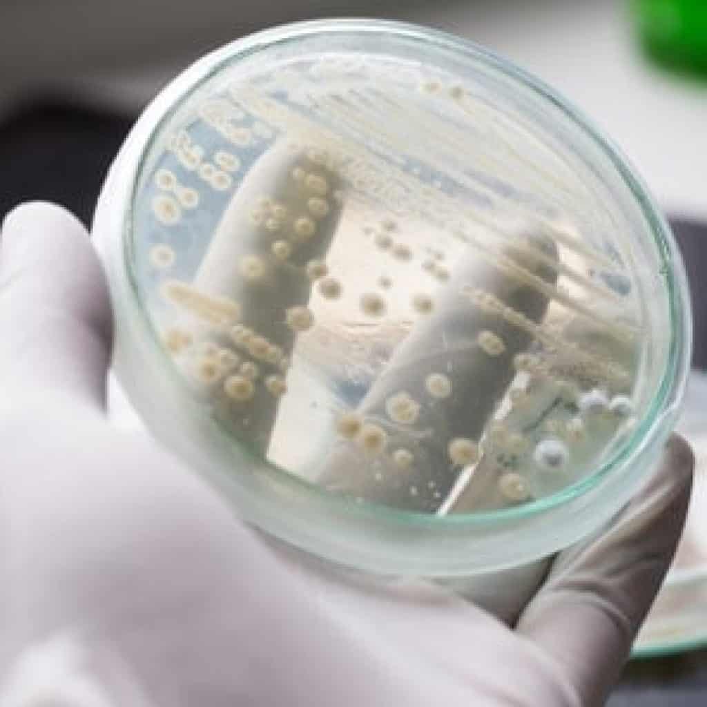 Amphasys Yeast Cell Viability