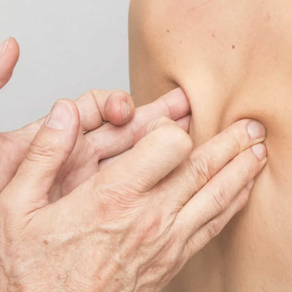 trigger point massage