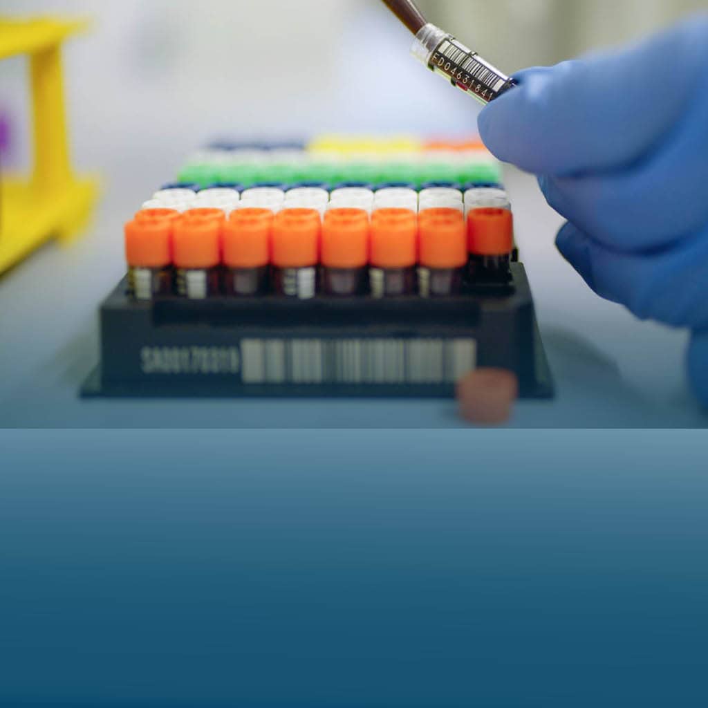 Probenröhrchen einer klinischen Studie mit Blut