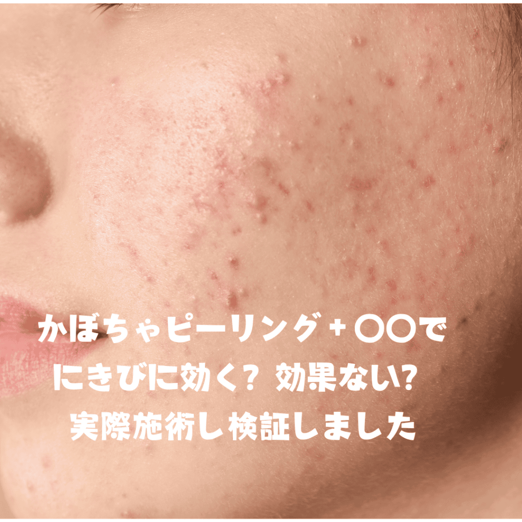 韓国で話題の４世代ピーリング＋〇〇導入でニキビに効く？効かない？実際の施術から検証してみました