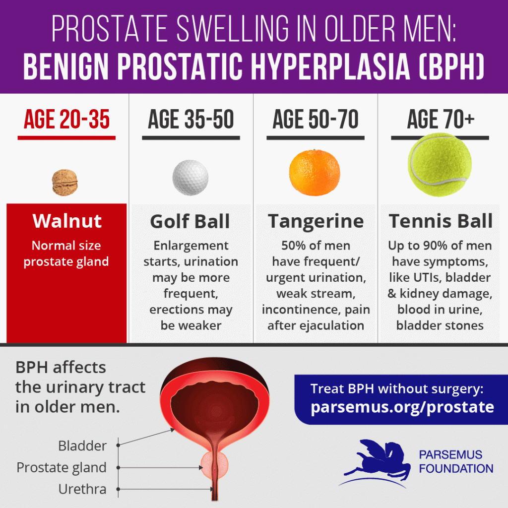 BPH-animated-infographic3