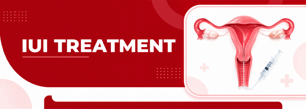 IUI Treatment in Srinagar