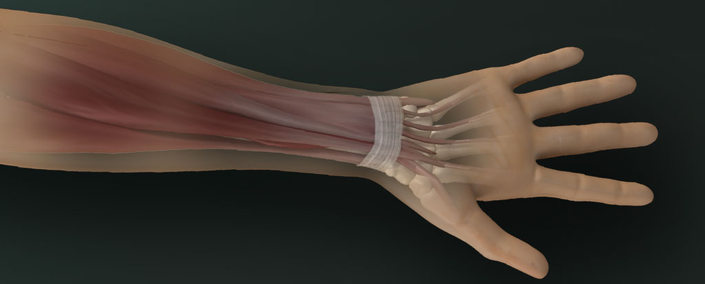 Carpal Tunnel / Repetitive Stress