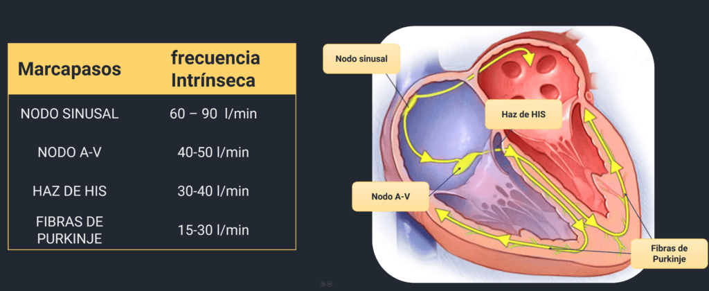 taquicardia ventricular