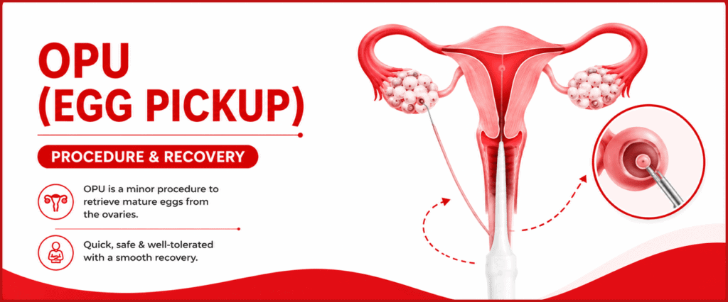 ovum pick-up