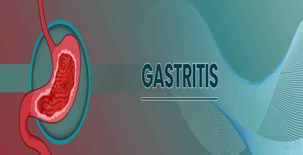 Informative guide on gastritis symptoms, causes, and natural homeopathic treatment options for stomach lining inflammation at Dr. Care.