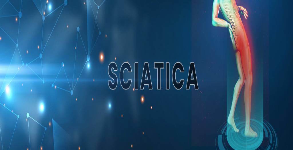 sciatic-blog