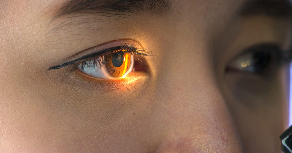 Glaucoma examination