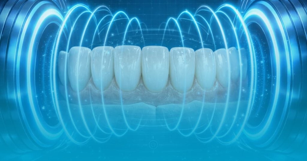 fatete dentare si rmn
