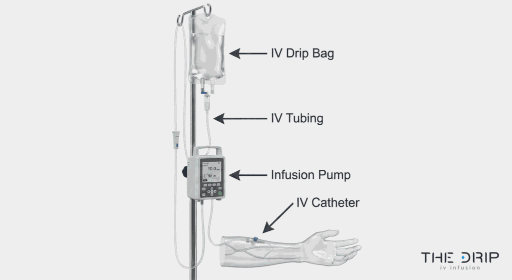 Diagram showing labeled IV therapy equipment including catheter, tubing, and pump.
