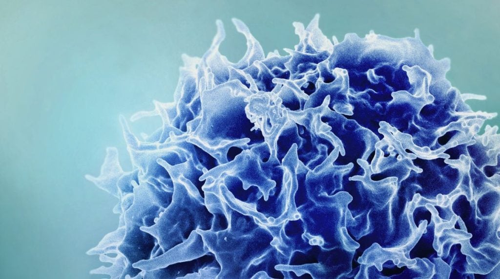 Immune cell
