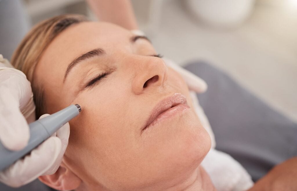 Is Your Skin Losing Its Bounce Try Microneedling in Regina to Restore the lost Collagen for Face