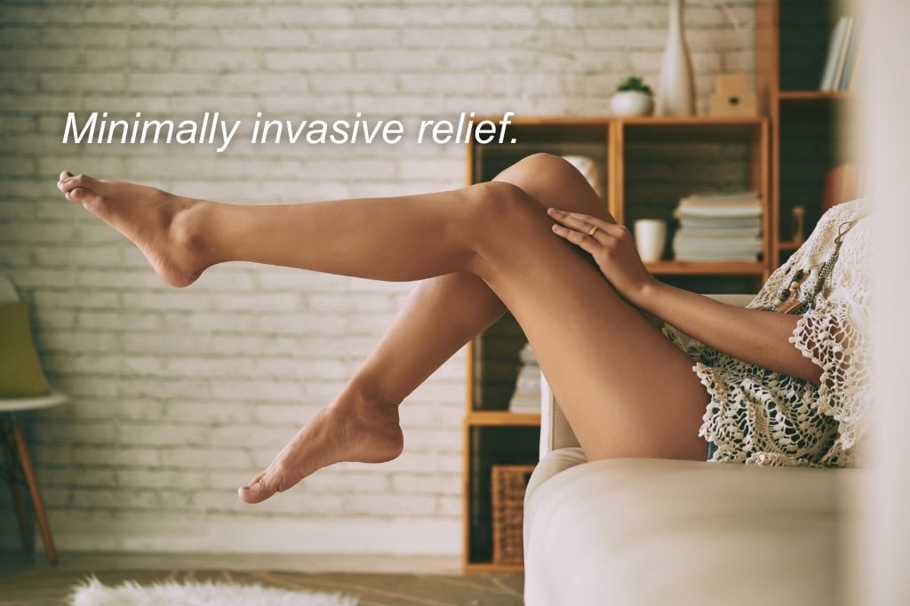 Patient enjoying relief after vein treatment in Nashville, TN | The Vein Guys board-certified vein specialists.