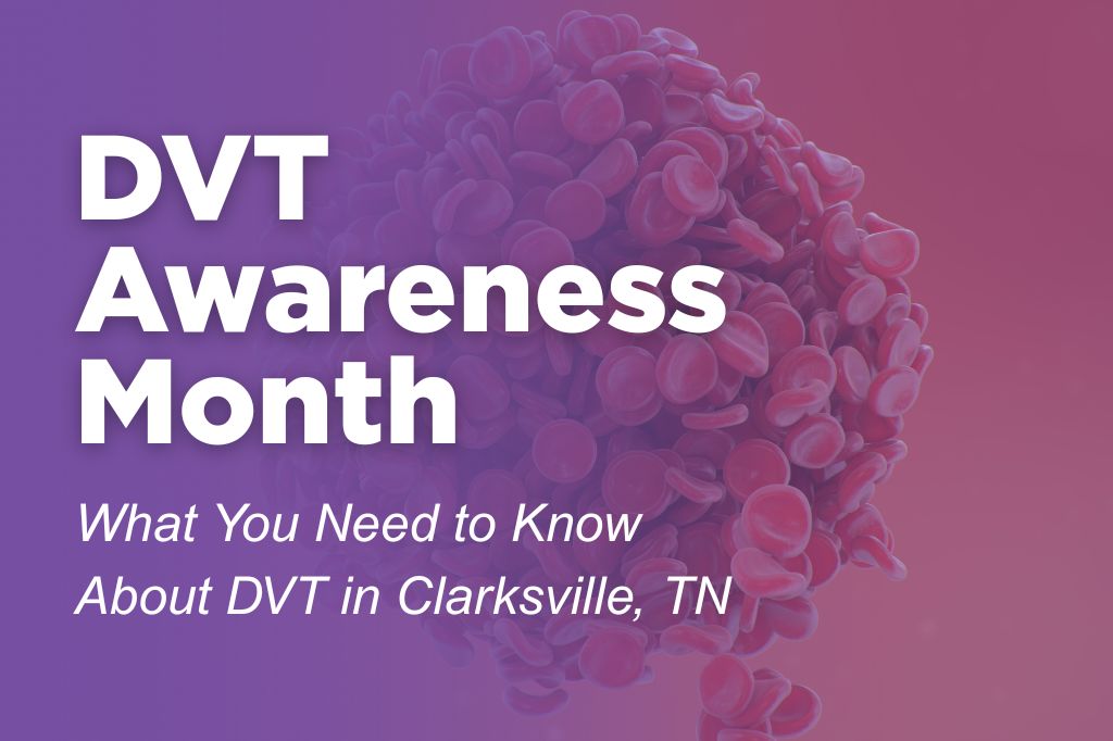 DVT Awareness Month graphic with red blood clot illustration and text “What You Need to Know About DVT in Clarksville, TN” | The Vein Guys (board-certified vein specialists)
