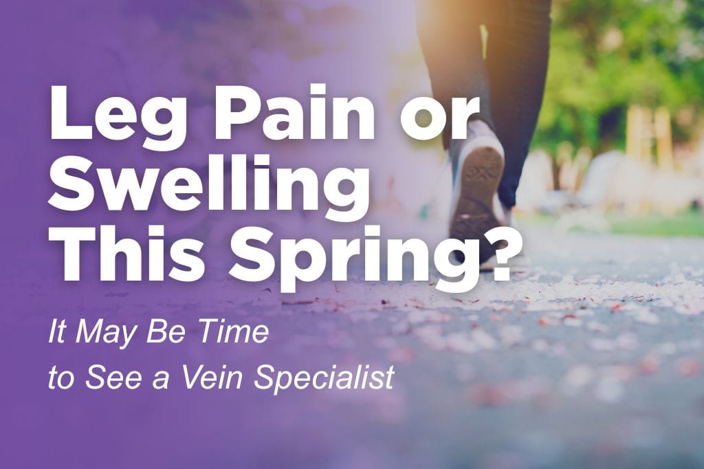 Leg pain or swelling worsens in spring. VIsit The Vein Guys in Augusta for treatment.
