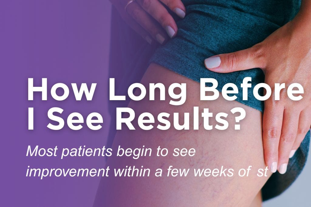 Woman pointing to her leg veins, answering how long after vein treatment patients see results.