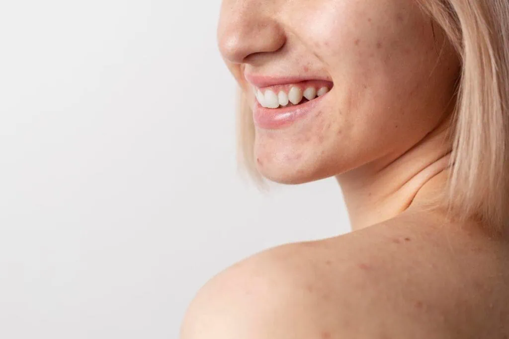 How to use aloe vera effectively for reducing scars - proven tips and benefits