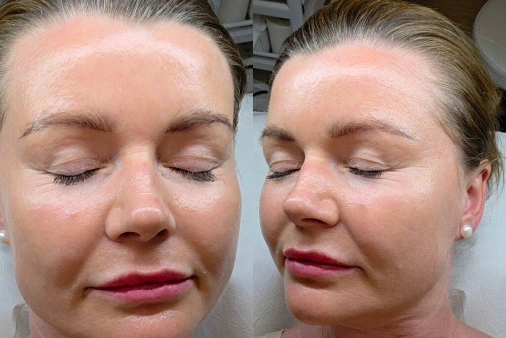 Glass Skin, Feuchtigkeit Behandlung, Haut Behandlung, Kosmetik Behandlung, Frische haut, Kosmetik Heidelberg, Kosmetik Salon Heidelberg