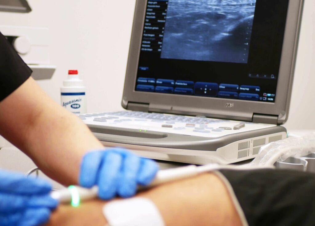Ecografía musculoesquelética en tratamiento de fisioterapia en Móstoles