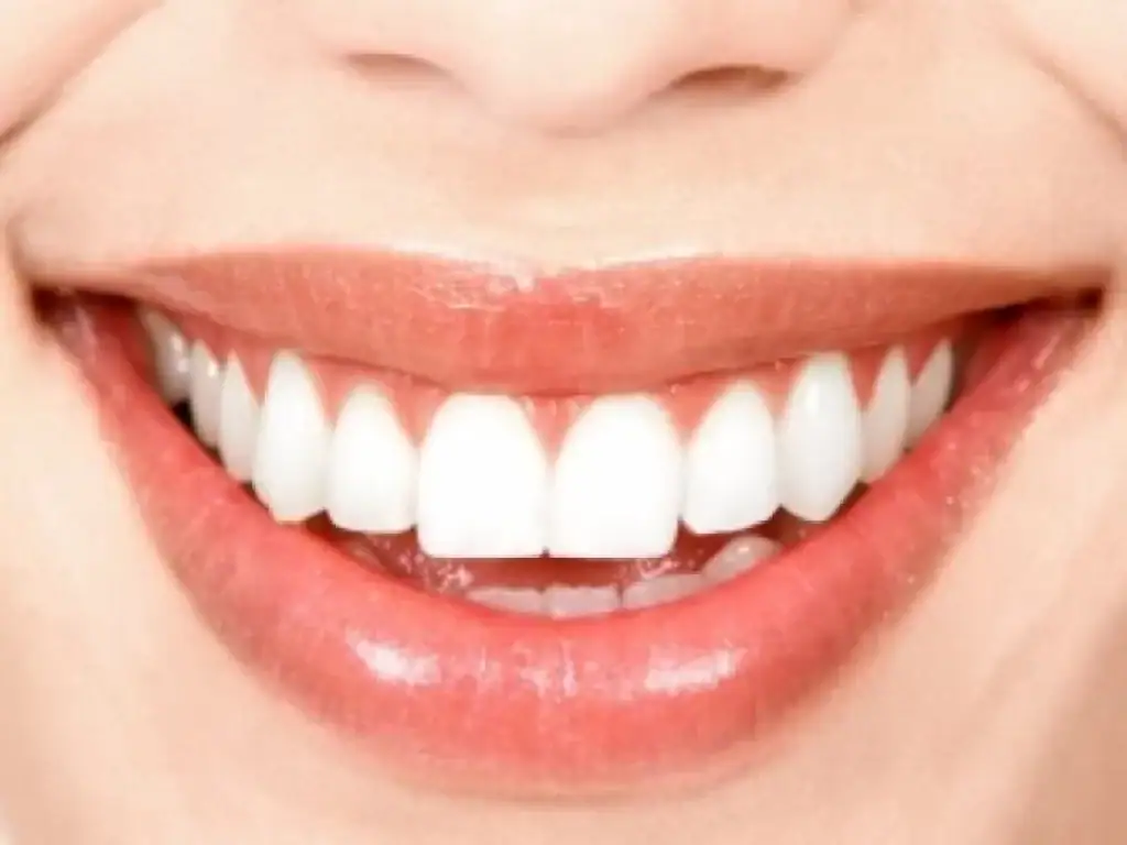 DENTES BRANCOS EM CASA: DESCUBRA OS SEGREDOS DO BRANQUEAMENTO DENTAL!