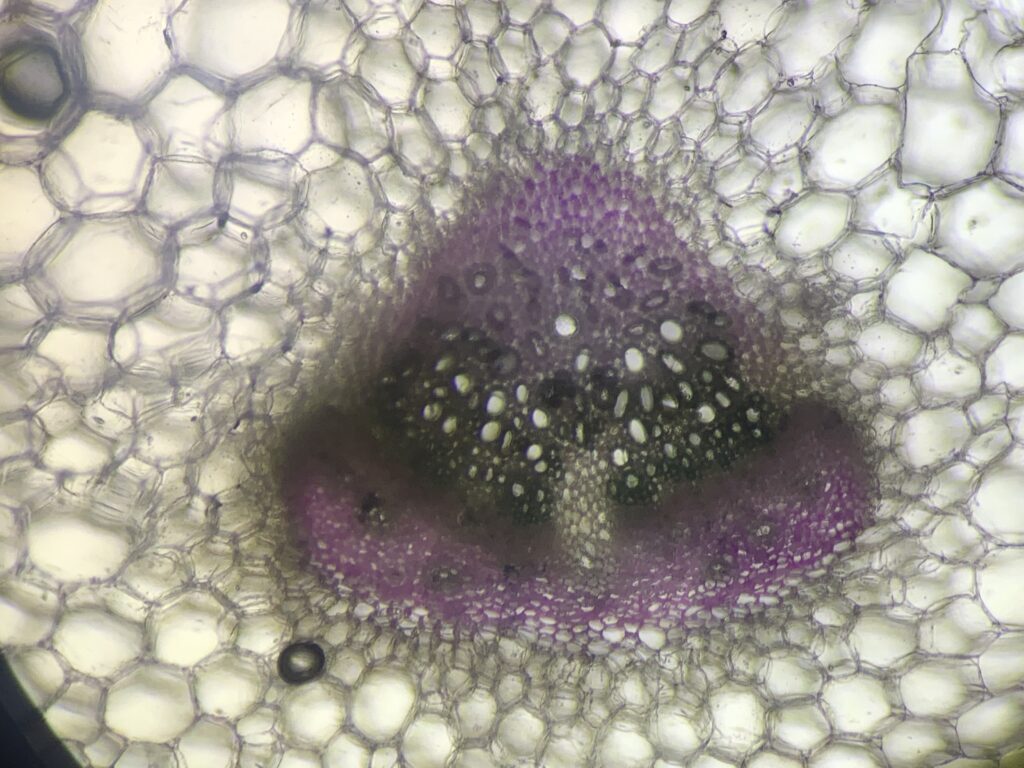 xylem&phloem