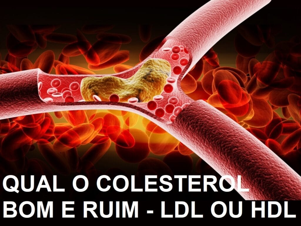 QUAL É O COLESTEROL BOM E O RUIM (HDL OU LDL) SAIBA QUAL AUMENTAR E QUAL DIMINUIR